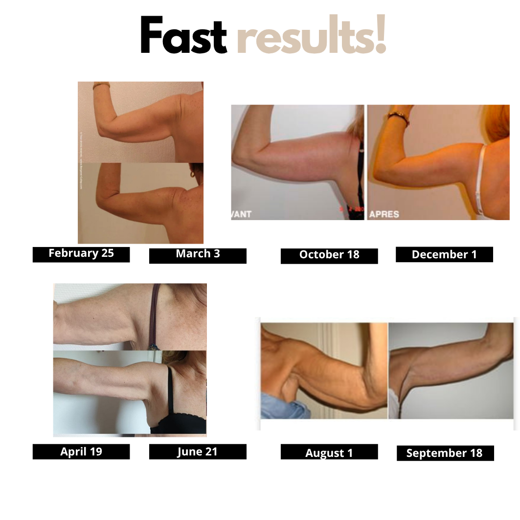 Body Shaping Sleeves